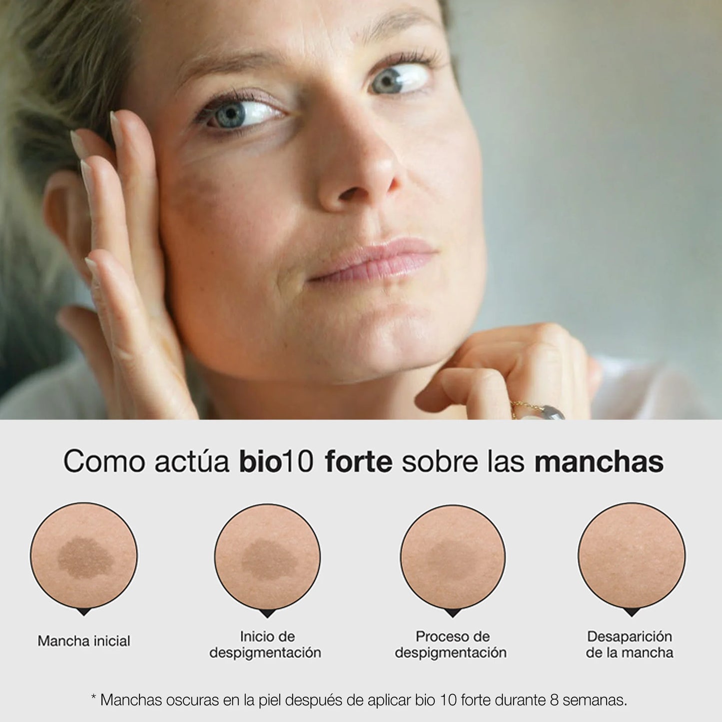 BELLA AURORA - Bio10 Forte 3 en 1, 10 ml, camufla las manchas de la piel con Color, despigmenta y protege, elimina las manchas oscuras, difumina las manchas e imperfecciones, Protección SPF 50+